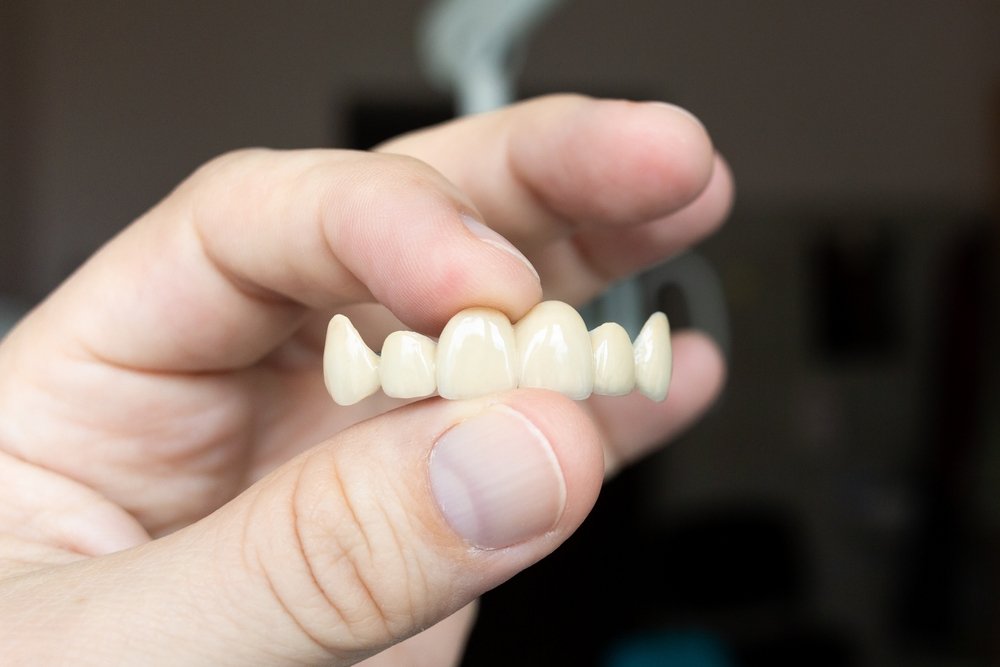 The,Dentist,Holds,A,Ceramic,,Zirconium,,Bridge-shaped,,Non-removable,Dental,Prosthesis